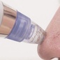 Вакуумный аппарат для чистки лица DermaSuction Вакуумный аппарат для чистки лица DermaSuction
