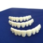 Виниры Instant SMILE Temporary Tooth Kit Виниры Instant SMILE Temporary Tooth Kit